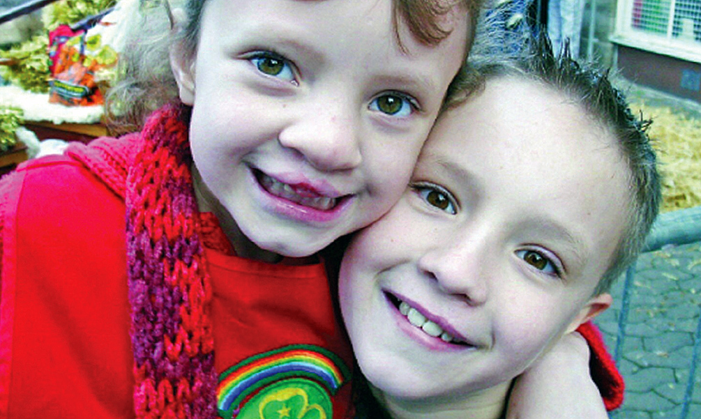 Clapa cleft palate charity kids.jpg